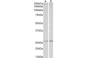 ABIN1781992 (0. (Peroxiredoxin 6 抗体  (Internal Region))