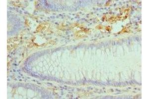 Immunohistochemistry (IHC) image for anti-Chemokine (C-C Motif) Ligand 28 (CCL28) (AA 20-127) antibody (ABIN7145996)