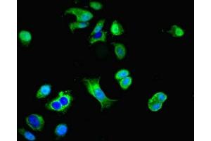 Immunofluorescent analysis of MCF-7 cells using ABIN7149644 at dilution of 1:100 and Alexa Fluor 488-congugated AffiniPure Goat Anti-Rabbit IgG(H+L) (GRID2IP 抗体  (AA 35-156))