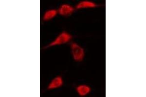 ABIN6276303 staining  Hela cells by IF/ICC. (DDIT3 抗体  (N-Term))
