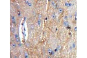 Immunohistochemistry (IHC) image for anti-Complement Component 1, Q Subcomponent, A Chain (C1QA) (AA 23-245) antibody (ABIN7440998)