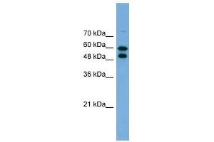 Western Blot showing PGM1 antibody used at a concentration of 1. (Phosphoglucomutase 1 抗体  (Middle Region))