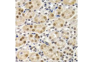 Immunohistochemistry of paraffin-embedded mouse kidney using ID3 antibody at dilution of 1:200 (400x lens). (ID3 抗体)