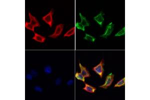 ABIN6259603 and ABIN6274618 staining Hela cells by IF/ICC. (CDKAL1 抗体  (N-Term))
