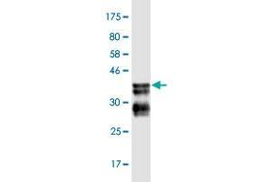 Western Blot detection against Immunogen (36. (BCL9 抗体  (AA 1036-1135))