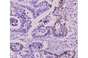 Immunohistochemistry (IHC) image for anti-Small Ubiquitin Related Modifier 2 (SUMO2) (AA 1-93), (N-Term) antibody (ABIN492386) (SUMO2 抗体  (N-Term))