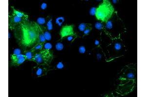 Anti-PDLIM2 mouse monoclonal antibody (ABIN2454449) immunofluorescent staining of COS7 cells transiently transfected by pCMV6-ENTRY PDLIM2 (RC210022). (PDLIM2 抗体)