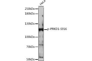 Western blot analysis of extracts of HeLa cells, using Phospho-PKC mu-S916 Rabbit pAb (ABIN7269642) at 1:1000 dilution. (PKC mu 抗体  (pSer916))