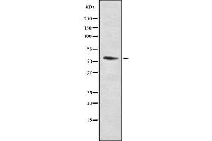 Western blot analysis of RMP using LOVO whole cell lysates (URI1 抗体  (Internal Region))