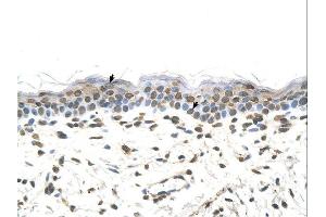 FTCD antibody was used for immunohistochemistry at a concentration of 4-8 ug/ml. (FTCD 抗体  (Middle Region))
