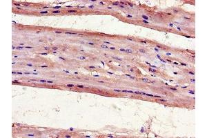 Immunohistochemistry of paraffin-embedded human heart tissue using ABIN7175097 at dilution of 1:100 (UNG 抗体  (AA 114-224))