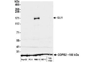 Western Blotting (WB) image for anti-Zinc Finger Protein GLI1 (GLI1) (C-Term) antibody (ABIN7795647)