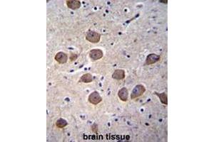Immunohistochemistry (Paraffin-embedded Sections) (IHC (p)) image for anti-Catenin (Cadherin-Associated Protein), delta 2 (Neural Plakophilin-Related Arm-Repeat Protein (CTNND2) (AA 1130-1159), (C-Term) antibody (ABIN951062)