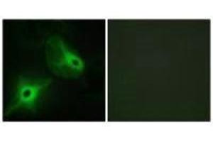 Immunofluorescence analysis of HeLa cells, using KSR2 antibody. (KSR2 抗体)