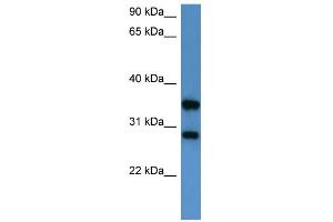 WB Suggested Anti-STYXL1 Antibody Titration: 0. (STYXL1 抗体  (Middle Region))