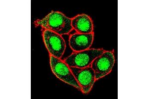 Confocal immunofluorescent analysis of Phospho-MUC1- Antibody (ABIN650864 and ABIN2839814) with Hela cell followed by Alexa Fluor 488-conjugated goat anti-rabbit lgG (green). (MUC1 抗体  (pThr1224))