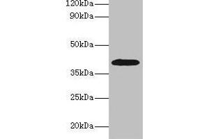 Western blot All lanes: ADH1B antibody at 2 μg/mL + HepG2 whole cell lysate Secondary Goat polyclonal to rabbit IgG at 1/15000 dilution Predicted band size: 40, 36 kDa Observed band size: 40 kDa (ADH1B 抗体  (AA 2-375))