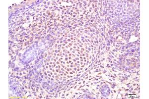 Formalin-fixed and paraffin embedded mouse embryo labeled with Rabbit Anti Osterix Polyclonal Antibody, Unconjugated (ABIN737811) at 1:200 followed by conjugation to the secondary antibody and DAB staining (SP7 抗体  (AA 331-431))