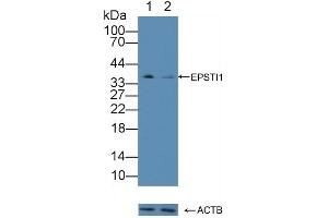 anti-Epithelial Stromal Interaction 1 (Breast) (EPSTI1) (AA 73-280) antibody