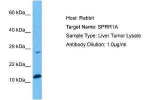 Host: Rabbit Target Name: SPRR1A Sample Tissue: Human Liver Tumor Antibody Dilution: 1ug/ml (SPRR1A 抗体  (Middle Region))