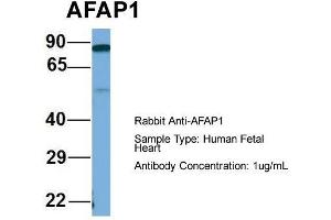 Host: Rabbit  Target Name: AFAP1  Sample Tissue: Human Fetal Heart  Antibody Dilution: 1. (AFAP 抗体  (Middle Region))