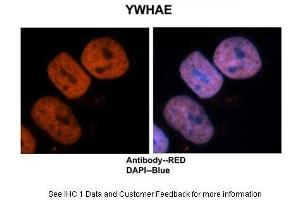 Sample Type :  Human brain stem cells  Primary Antibody Dilution :  1:500  Secondary Antibody :  Goat anti-rabbit Alexa-Fluor 594  Secondary Antibody Dilution :  1:1000  Color/Signal Descriptions :  Ywhae: Red DAPI:Blue  Gene Name :  Ywhae  Submitted by :  Dr. (YWHAE 抗体  (C-Term))