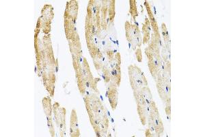 Immunohistochemistry of paraffin-embedded rat heart using COPB2 antibody (ABIN5974232) at dilution of 1/100 (40x lens). (COPB2 抗体)