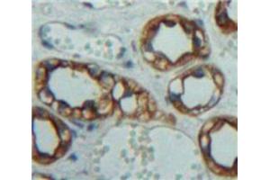 Used in DAB staining on fromalin fixed paraffin-embedded Kidney tissue (IL-10RA 抗体  (AA 17-241))