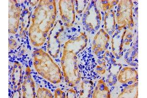 Immunohistochemistry (IHC) image for anti-Nuclear Receptor Subfamily 3, Group C, Member 1 (Glucocorticoid Receptor) (NR3C1) (AA 1-190) antibody (ABIN7153886)