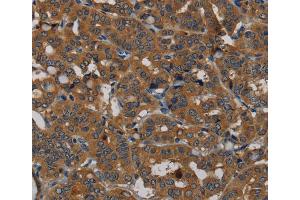 Immunohistochemistry (IHC) image for anti-phosphodiesterase 5A, cGMP-Specific (PDE5A) antibody (ABIN2433559) (PDE5A 抗体)