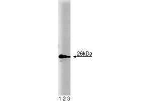 Western blot analysis of Bcl-2 (clone 7) on Jurkat cell lysate. (Bcl-2 抗体  (AA 49-179))