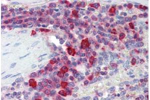 Human Spleen (formalin-fixed, paraffin-embedded) stained with PIM3 antibody ABIN462148 followed by biotinylated goat anti-rabbit IgG secondary antibody ABIN481713, alkaline phosphatase-streptavidin and chromogen. (PIM3 抗体  (AA 259-288))