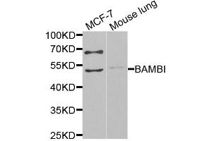 Western blot analysis of extracts of various cell lines, using BAMBI antibody (ABIN6291816) at 1:1000 dilution.