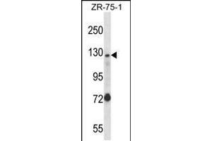 Western blot analysis in ZR-75-1 cell line lysates (35ug/lane). (UBE4A 抗体  (AA 451-479))