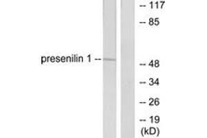 Western blot analysis of extracts from mouse heart cells, using Presenilin 1 Antibody. (Presenilin 1 抗体  (AA 1-50))