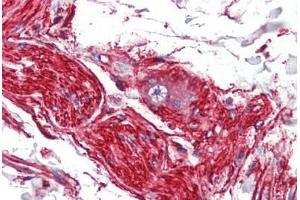 Human Nerve and Ganglion Cell (formalin-fixed, paraffin-embedded) stained with S100A10 antibody ABIN462133 followed by biotinylated anti-mouse IgG secondary antibody ABIN481714, alkaline phosphatase-streptavidin and chromogen. (S100A10 抗体)