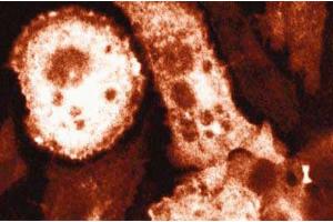 Immunofluorescence staining of mouse macrophages stimulated with 10 ng/mL IFNgamma and 1 µg/mL LPS. (NOS2 抗体  (AA 961-1144))