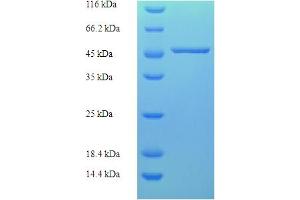 SDS-PAGE (SDS) image for Capping Protein (Actin Filament) Muscle Z-Line, alpha 2 (CAPZA2) (AA 2-286) protein (His-SUMO Tag) (ABIN5709197) (CAPZA2 Protein (AA 2-286) (His-SUMO Tag))
