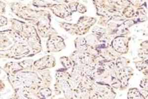 Immunohistochemistry analysis of paraffin-embedded human placenta using,SUN2 (ABIN7075502) at dilution of 1: 4000