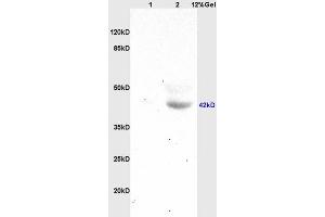 Lane 1: mouse brain lysates Lane 2: human colon carcinoma lysates probed with Anti HOXA10 Polyclonal Antibody, Unconjugated (ABIN741195) at 1:200 in 4 °C. (HOXA10 抗体  (AA 311-410))