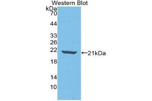 Western Blotting (WB) image for anti-Interleukin 18 Binding Protein (IL18BP) (AA 31-194) antibody (ABIN1859372) (IL18BP 抗体  (AA 31-194))