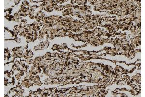 ABIN6277015 at 1/100 staining Human lung tissue by IHC-P. (Dystonin 抗体  (C-Term))