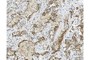 IHC analysis of USP16 using anti-USP16 antibody (ABIN7602640). (USP16 抗体  (AA 9-823))