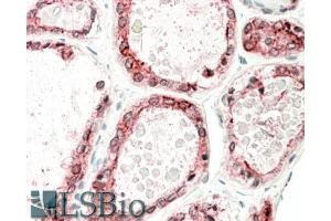 ABIN870640 (5µg/ml) staining of paraffin embedded Human Thyroid Gland. (Thyroperoxidase 抗体  (Internal Region))