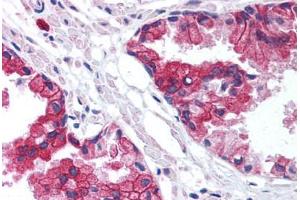 Human Prostate (formalin-fixed, paraffin-embedded) stained with TMED10 antibody ABIN214004 at 5 ug/ml followed by biotinylated goat anti-rabbit IgG secondary antibody ABIN481713, alkaline phosphatase-streptavidin and chromogen. (TMED10 抗体  (Internal Region))