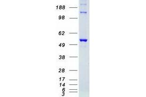 STK38 Protein (Myc-DYKDDDDK Tag)