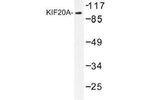 Image no. 1 for anti-Kinesin Family Member 20A (KIF20A) antibody (ABIN317796) (KIF20A 抗体)