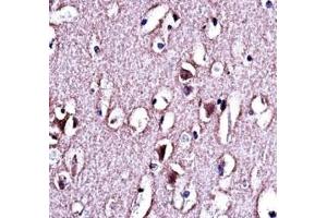LMO2 antibody immunohistochemistry analysis in formalin fixed and paraffin embedded human brain tissue. (LMO2 抗体  (AA 1-30))