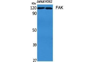 Western Blot (WB) analysis of specific cells using FAK Polyclonal Antibody. (FAK 抗体  (Thr435))
