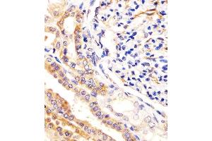 (ABIN388879 and ABIN2850431) staining USP2 in human kidney tissue sections by Immunohistochemistry (IHC-P - paraformaldehyde-fixed, paraffin-embedded sections). (USP2 抗体  (C-Term))